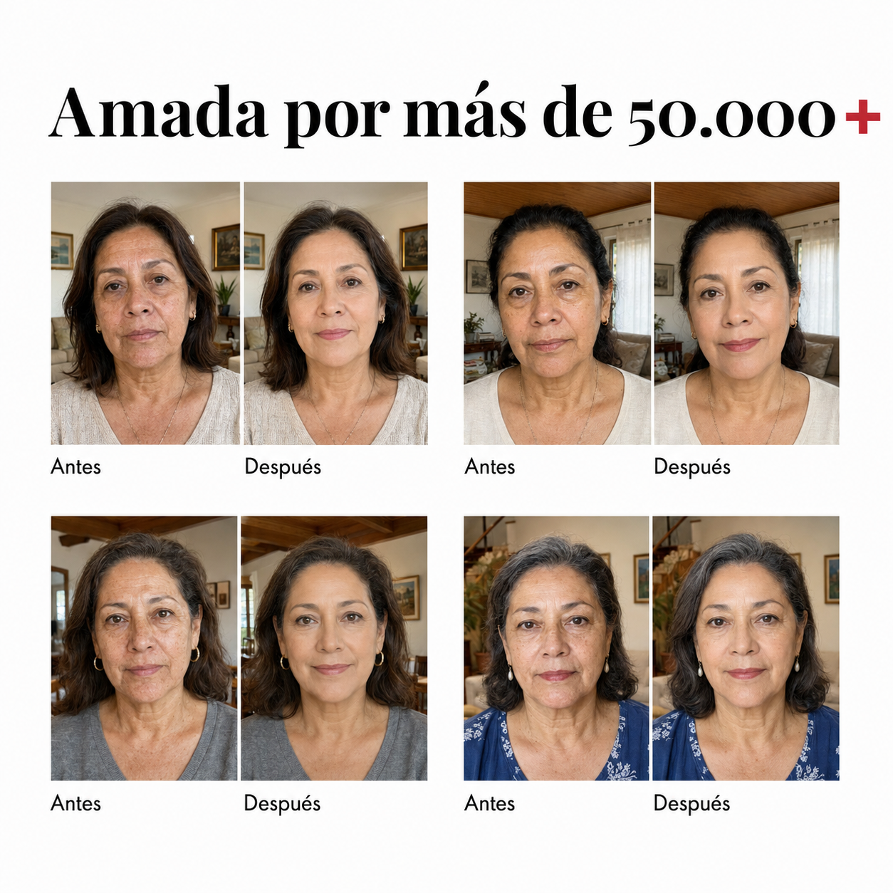 Skinmatch Smooche -  Koriderma